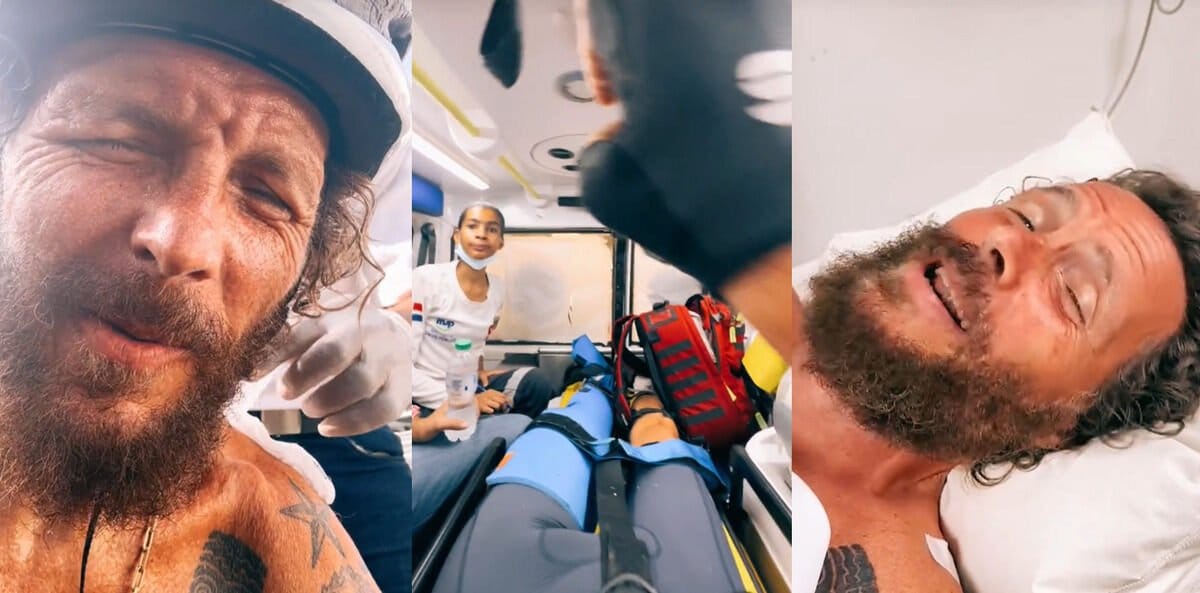 Jovanotti cade in bici a Santo Domingo: frattura della clavicola e femore rotto in tre punti